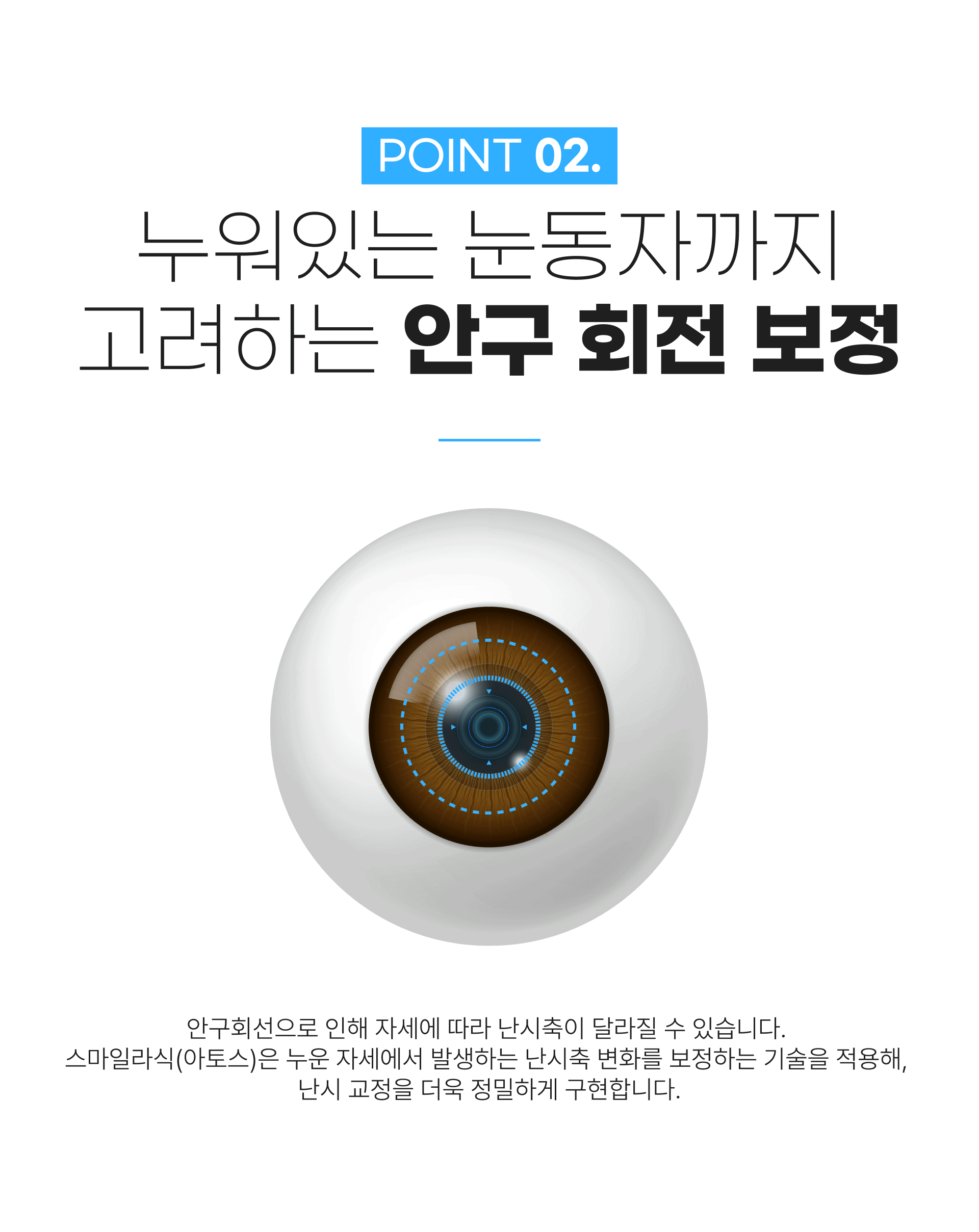 스마트 스마일 라식 특징 2